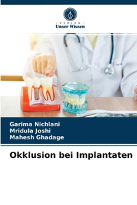 Okklusion bei Implantaten