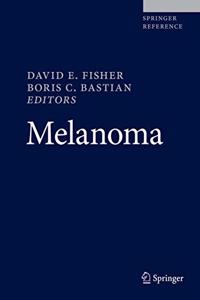 Melanoma