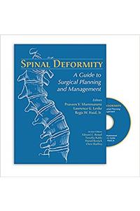 Spinal Deformity