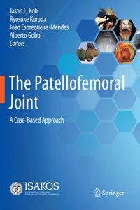 Patellofemoral Joint