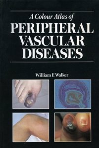 A Colour Atlas of Peripheral Vascular Diseases