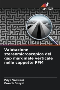 Valutazione stereomicroscopica del gap marginale verticale nelle cappette PFM