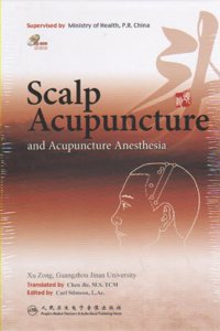 Scalp Acupuncture