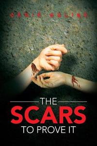 Scars to Prove It