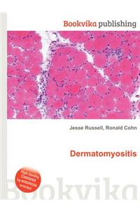 Dermatomyositis