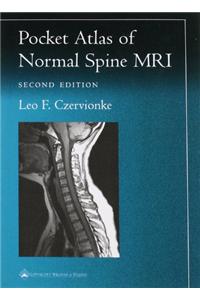 Pocket Atlas of Spinal MRI