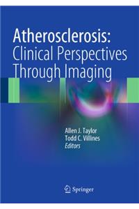 Atherosclerosis: Clinical Perspectives Through Imaging