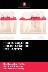 Protocolo de Colocação de Implantes