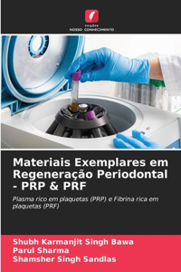 Materiais Exemplares em Regeneração Periodontal - PRP & PRF