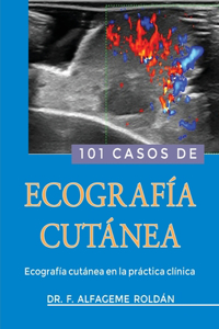 101 Casos de Ecografia Cutanea