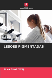 Lesões Pigmentadas