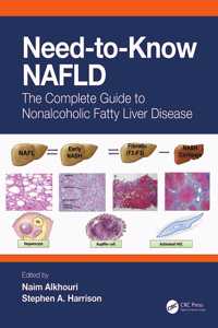 Need-to-Know NAFLD