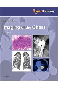 Imaging of the Chest, 2-Volume Set