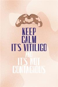Keep Calm It's Vitiligo And It's Not contagious