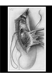 Suspension of the Kidney Notebook