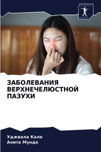 ЗАБОЛЕВАНИЯ ВЕРХНЕЧЕЛЮСТНОЙ ПАЗУХИ