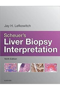 Scheuer's Liver Biopsy Interpretation