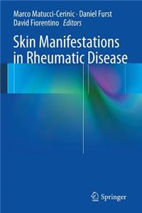 Skin Manifestations in Rheumatic Disease