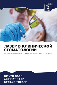 ЛАЗЕР В КЛИНИЧЕСКОЙ СТОМАТОЛОГИИ