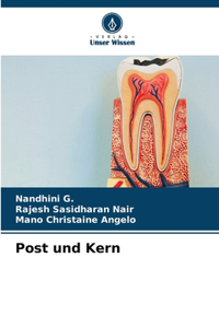 Post und Kern