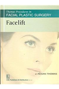 Thomas Procedures in Facial Plastic Surgery: Facelift