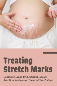 Treating Stretch Marks