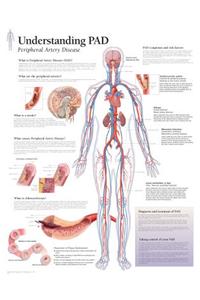 Understanding PAD Laminated Poster