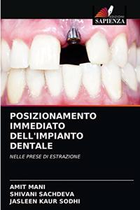 Posizionamento Immediato Dell'impianto Dentale