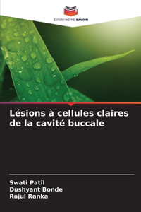 Lésions à cellules claires de la cavité buccale