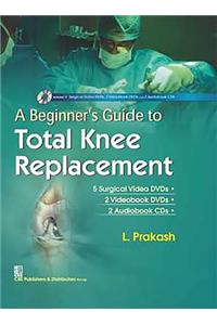 A Beginner's Guide to Total Knee Replacement