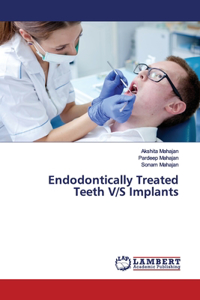 Endodontically Treated Teeth V/S Implants