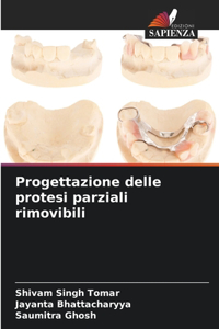 Progettazione delle protesi parziali rimovibili