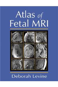 Atlas of Fetal MRI