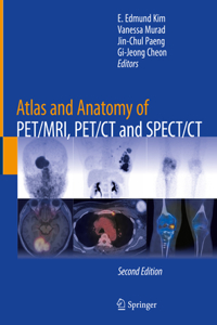 Atlas and Anatomy of Pet/Mri, Pet/CT and Spect/CT