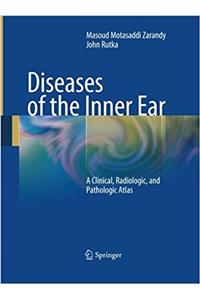 Diseases of the Inner Ear