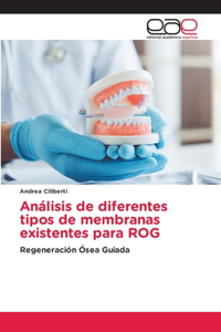 Análisis de diferentes tipos de membranas existentes para ROG