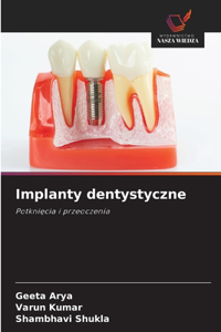 Implanty dentystyczne