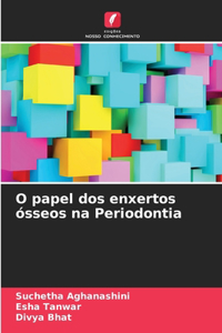 O papel dos enxertos ósseos na Periodontia