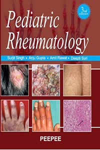 Pediatric Rheumatology