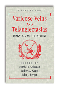 Varicose Veins and Telangiectasias: Diagnosis and Treatment, Second Edition