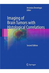 Imaging of Brain Tumors with Histological Correlations