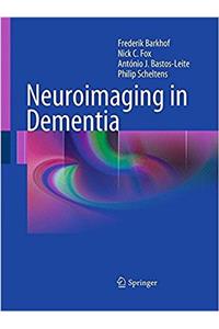 Neuroimaging in Dementia