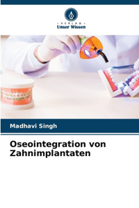 Oseointegration von Zahnimplantaten