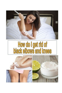 How do I get rid of black elbows and knees