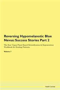 Reversing Hypomelanotic Blue Nevus