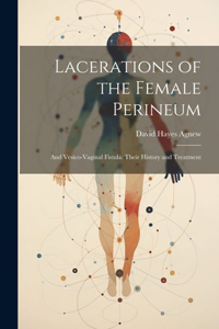 Lacerations of the Female Perineum