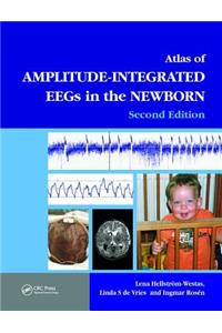 Atlas of Amplitude-Integrated Eegs in the Newborn