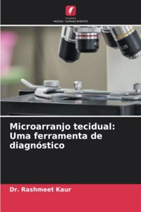 Microarranjo tecidual