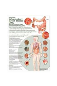 Understanding Inflammatory Bowel Disease (Ibd) Anatomical Chart