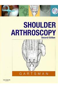 Shoulder Arthroscopy